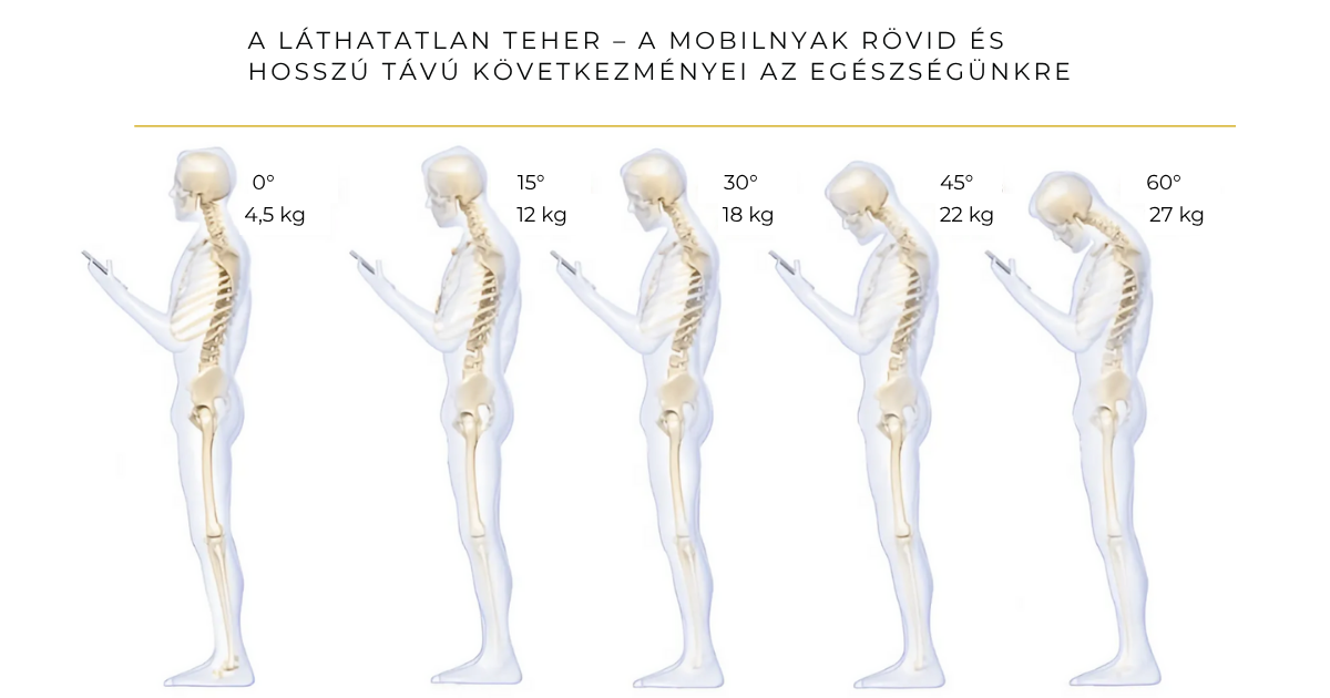 Az előrehajtott fejtartás szintjei és a nyaki gerincre nehezedő súly növekedése mobilhasználat közben.